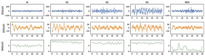 MMASleepNet: A multimodal attention network based on electrophysiological signals for automatic sleep staging